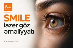 smile lazer goz emeliyyat