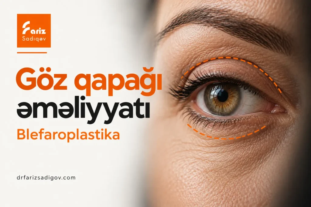 bleforaplastika əməliyyatı