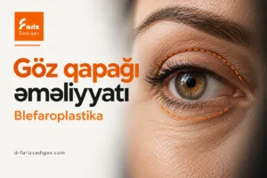 bleforaplastika əməliyyatı